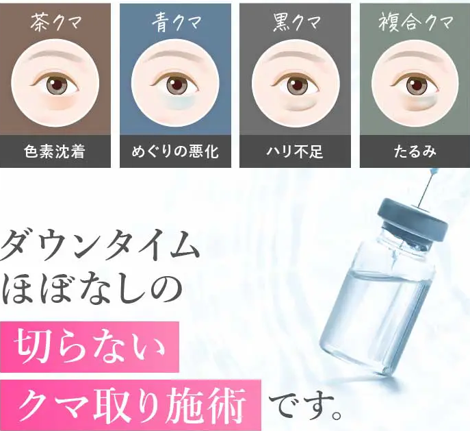 TCBの再生注射と切らないクマ取りを併用した施術