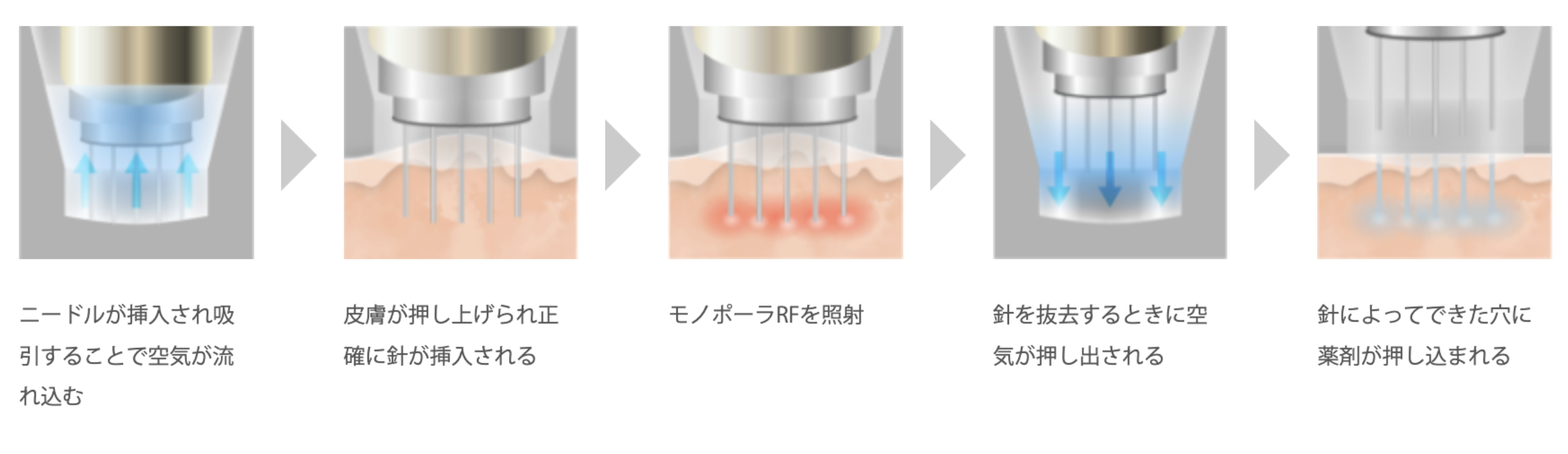 ルラクリニック　ポテンツァ　口コミ