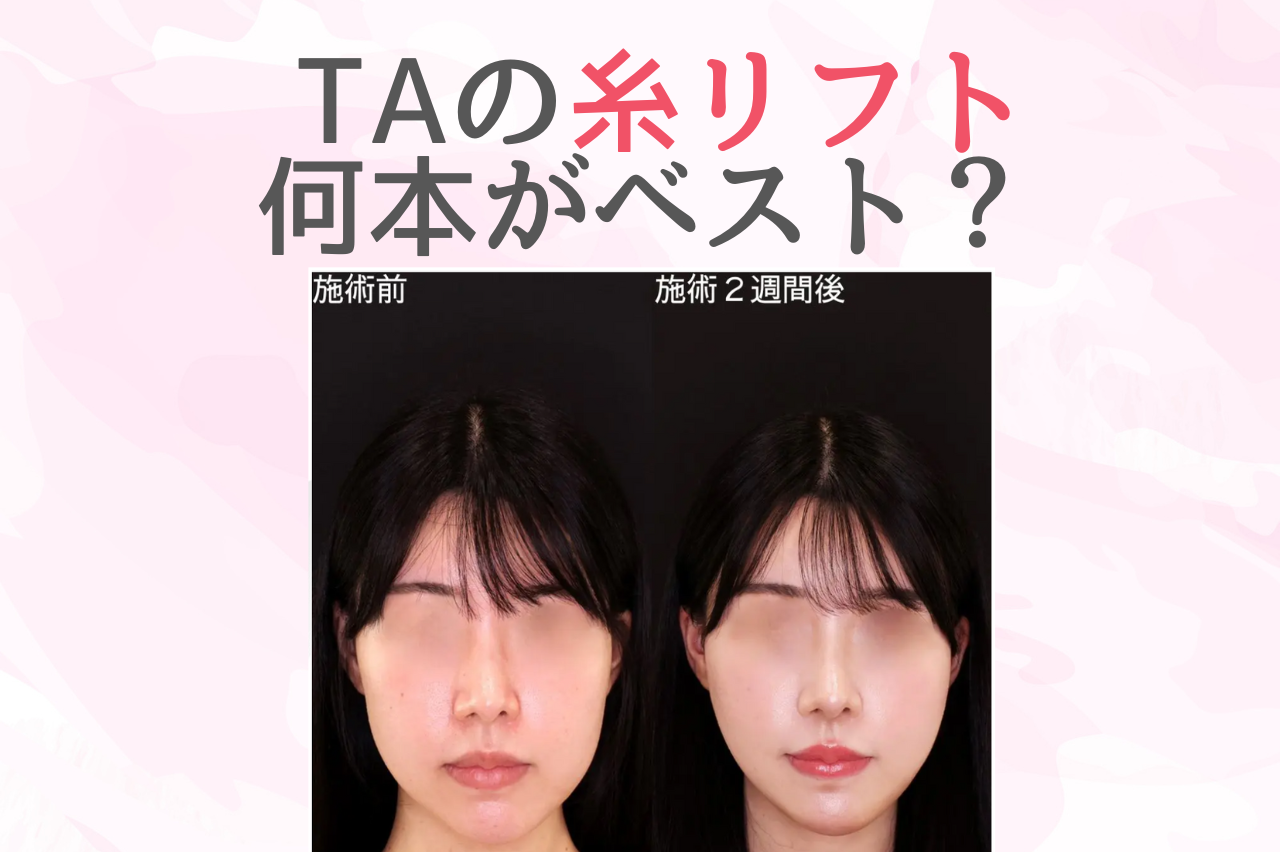 TAクリニックの糸リフトは何本が多い?口コミで解説