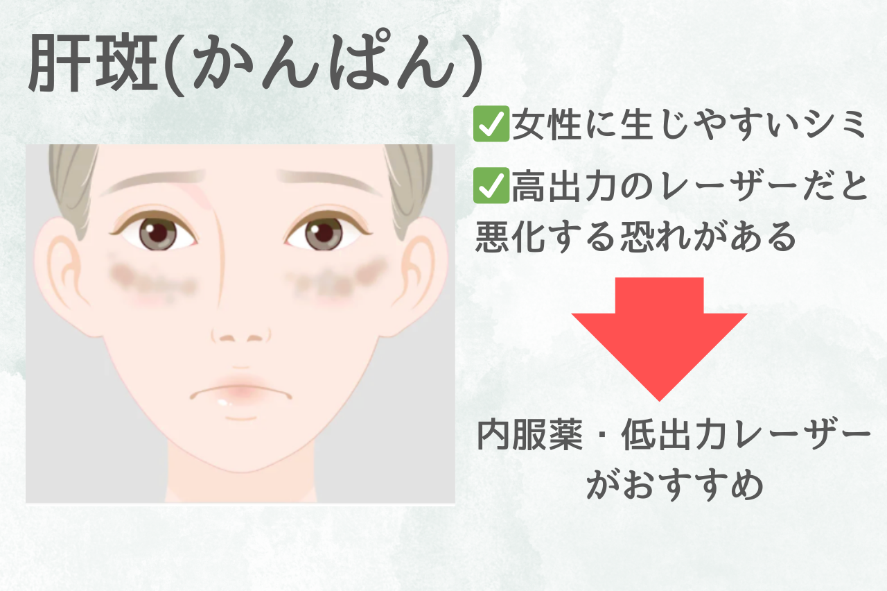 肝斑の悩みでシミ取りをした人の口コミ