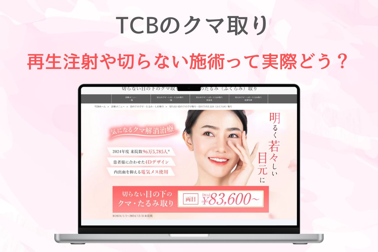 TCB クマ取り　評判