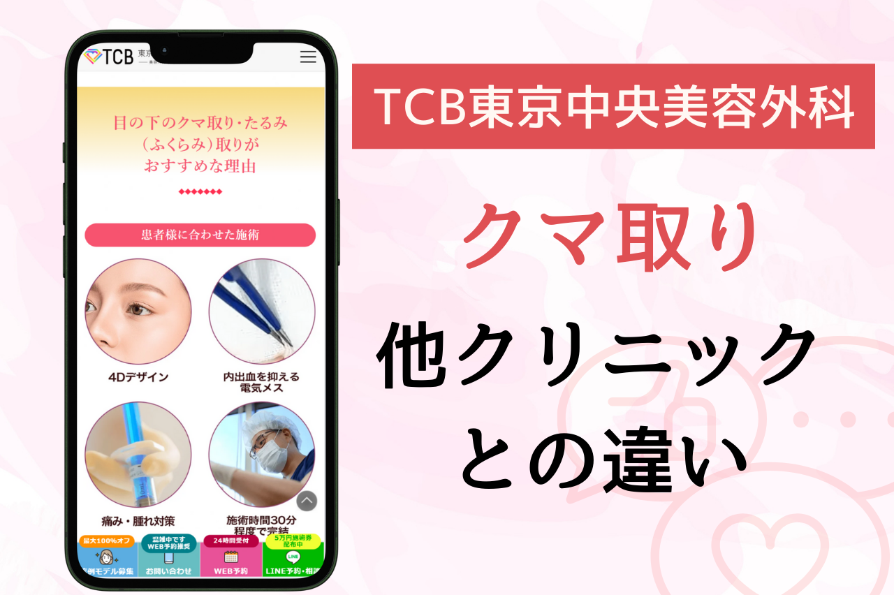 TCBのクマ取りはなぜ人気？　評判