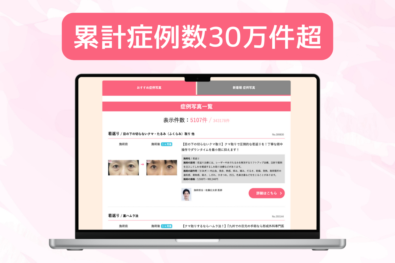 湘南　クマ取り　人気の理由