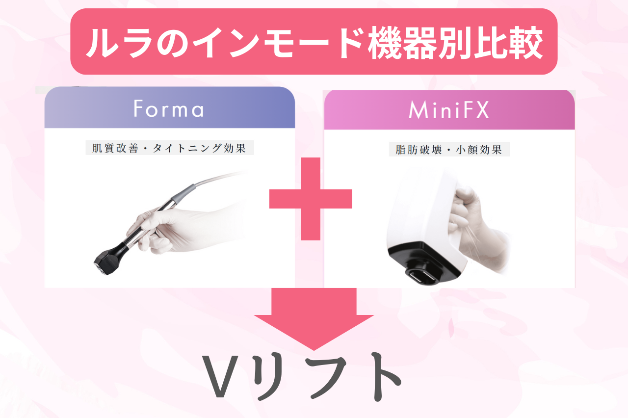 ルラのインモードの機能別比較！機能別で向いている人を紹介