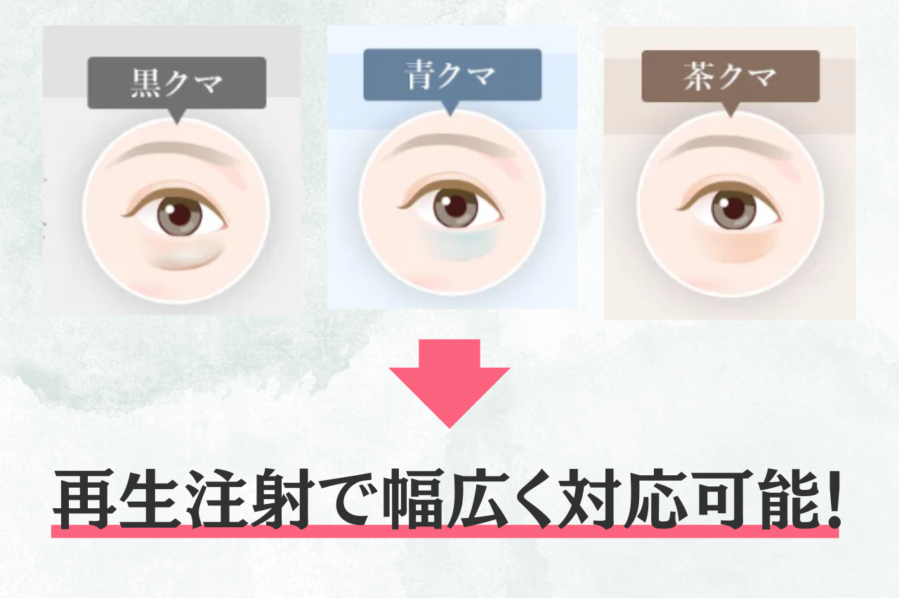 TCB クマ取り　評判