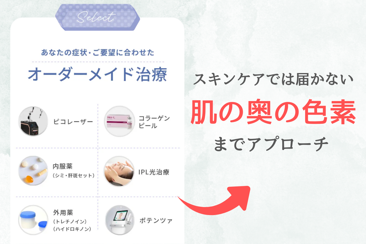 TCB シミ取り　効果