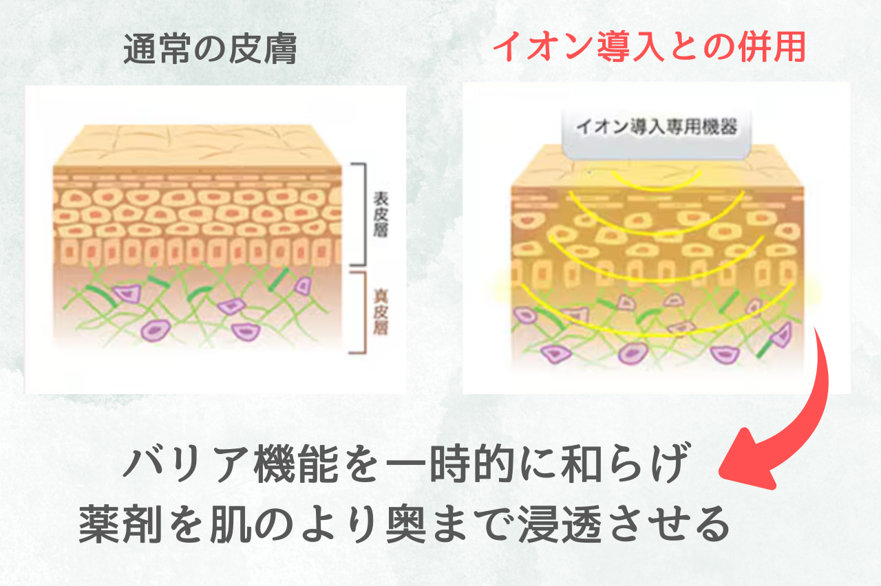 湘南　ケミカルピーリング　口コミ