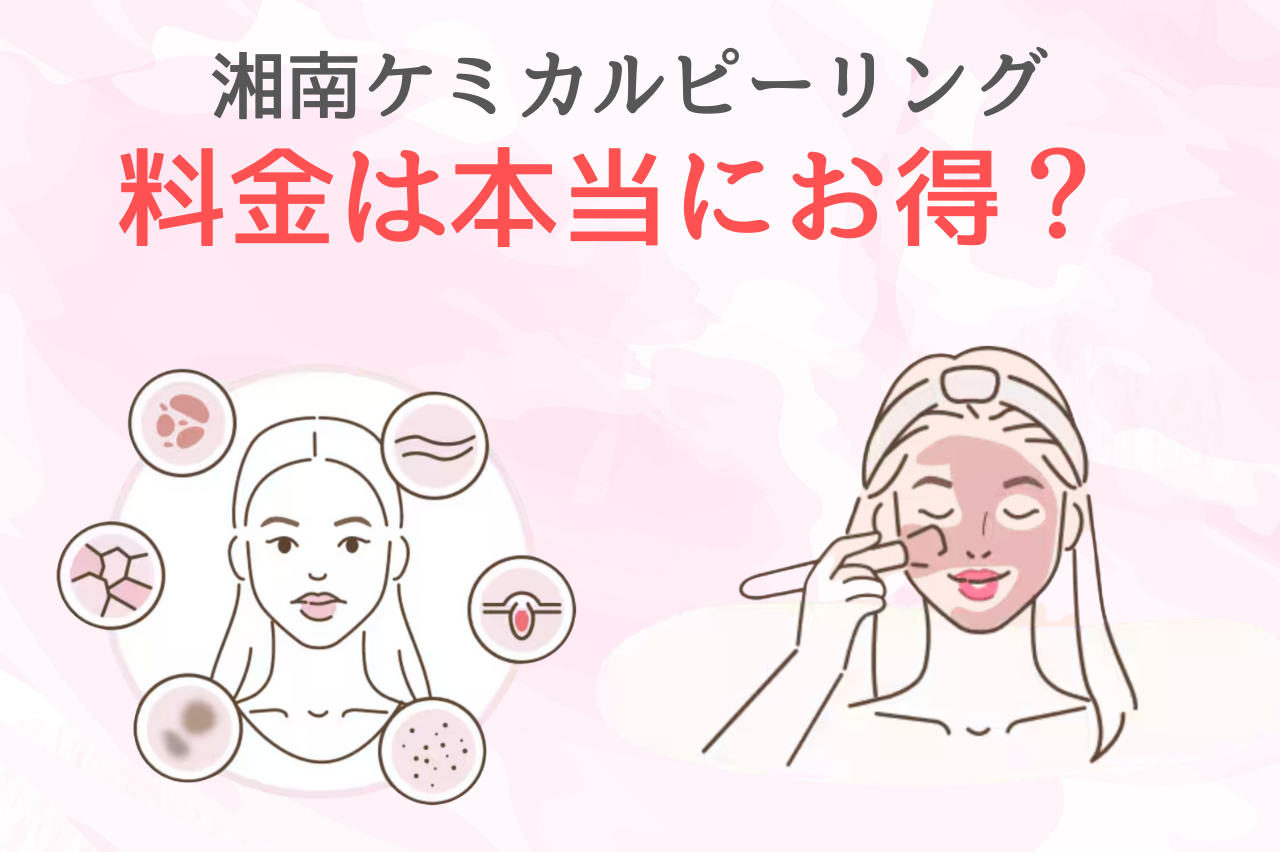 湘南　ケミカルピーリング　料金