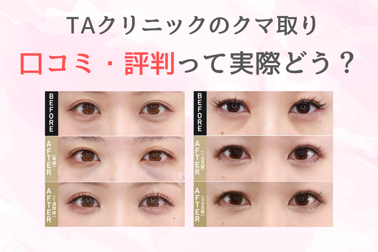TAクリニック　クマ取り　口コミ