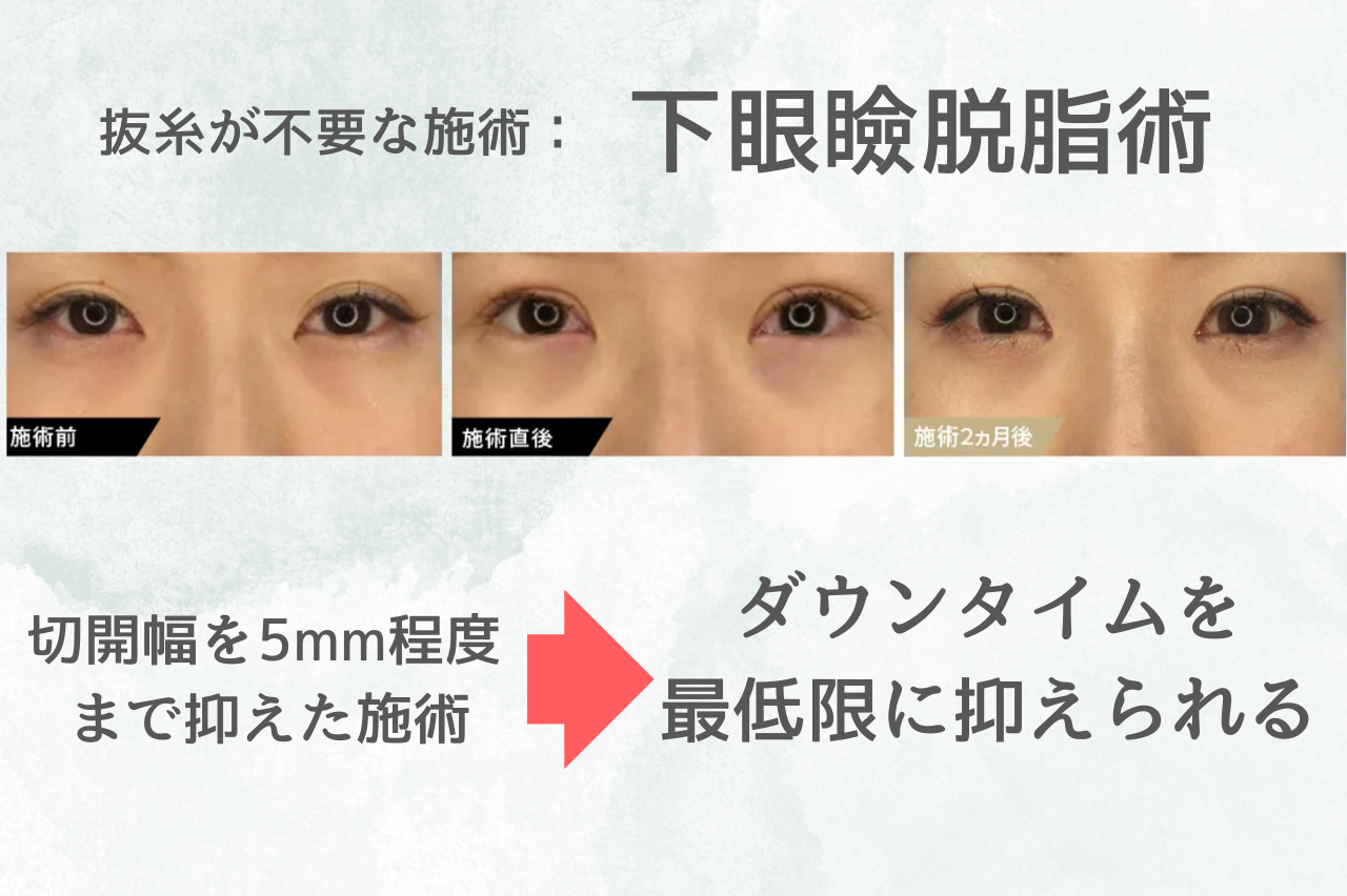 TAクリニック　クマ取り　口コミ
