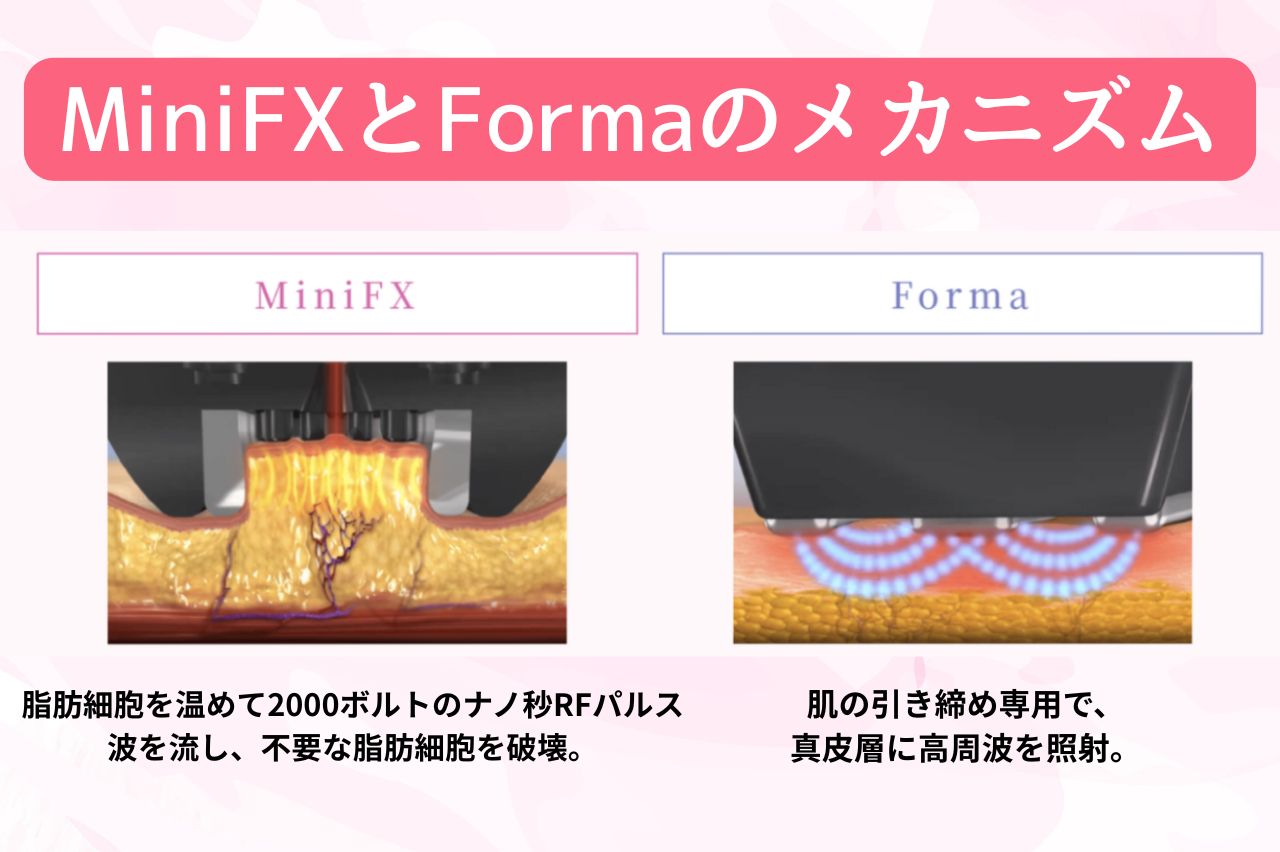MiniFXでインモードを受けた人の口コミ