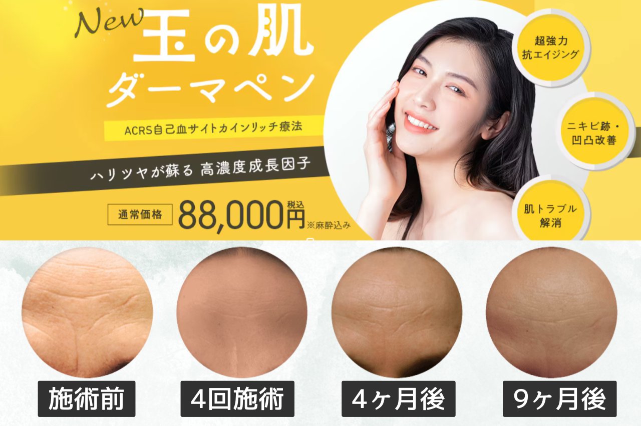 湘南　ダーマペン　口コミ　症例