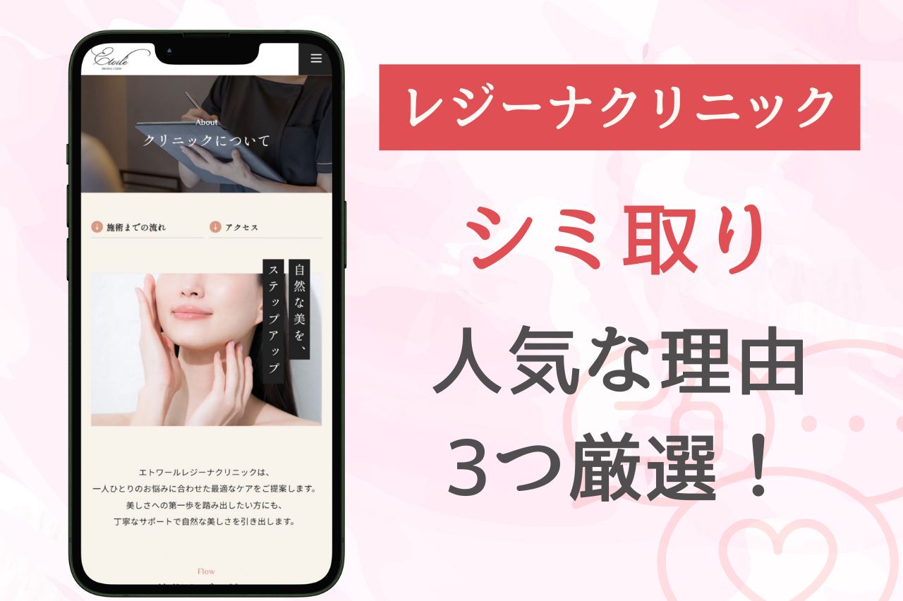 エトワールレジーナクリニックのシミ取りが人気の理由は？