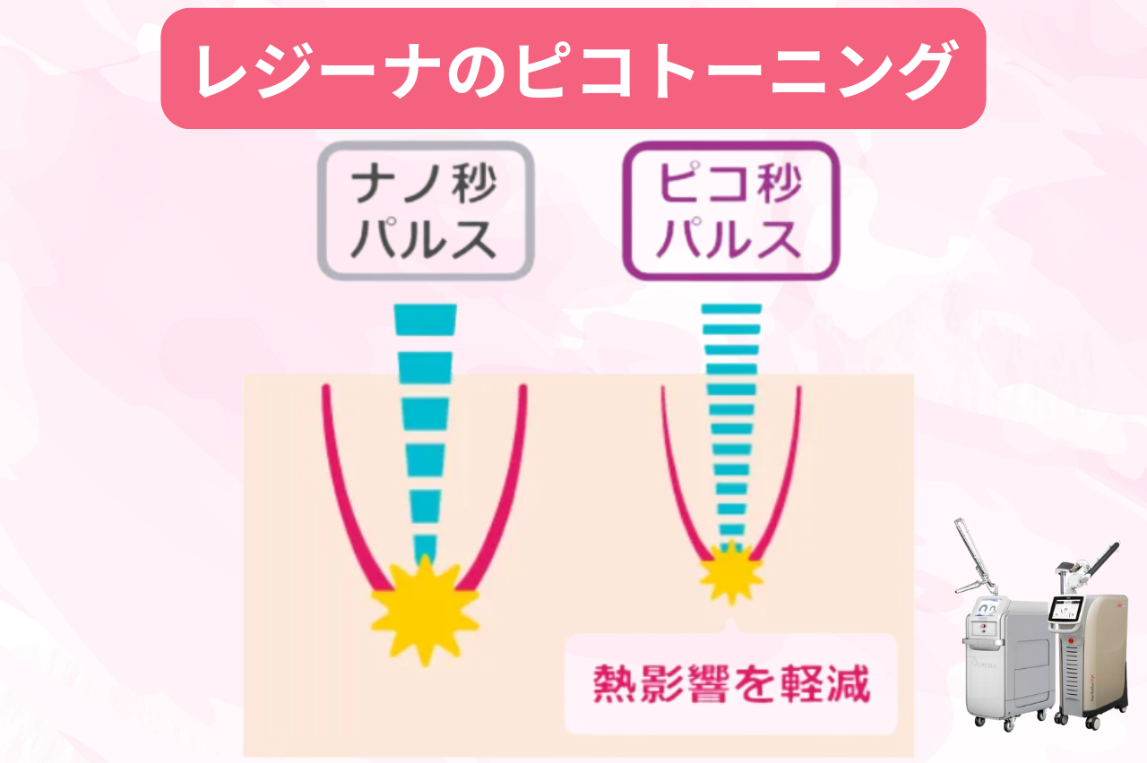 エトワールレジーナクリニックのシミ取りが人気の理由は？