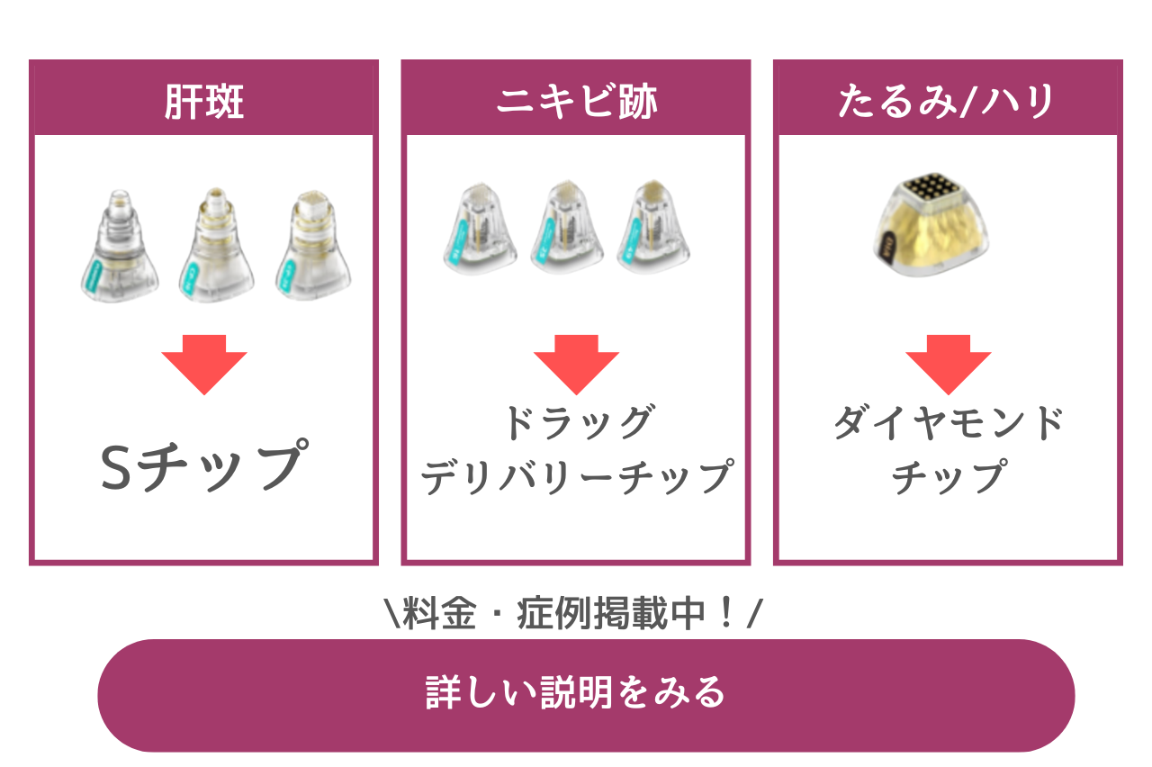 ルラクリニック　ポテンツァ　口コミ