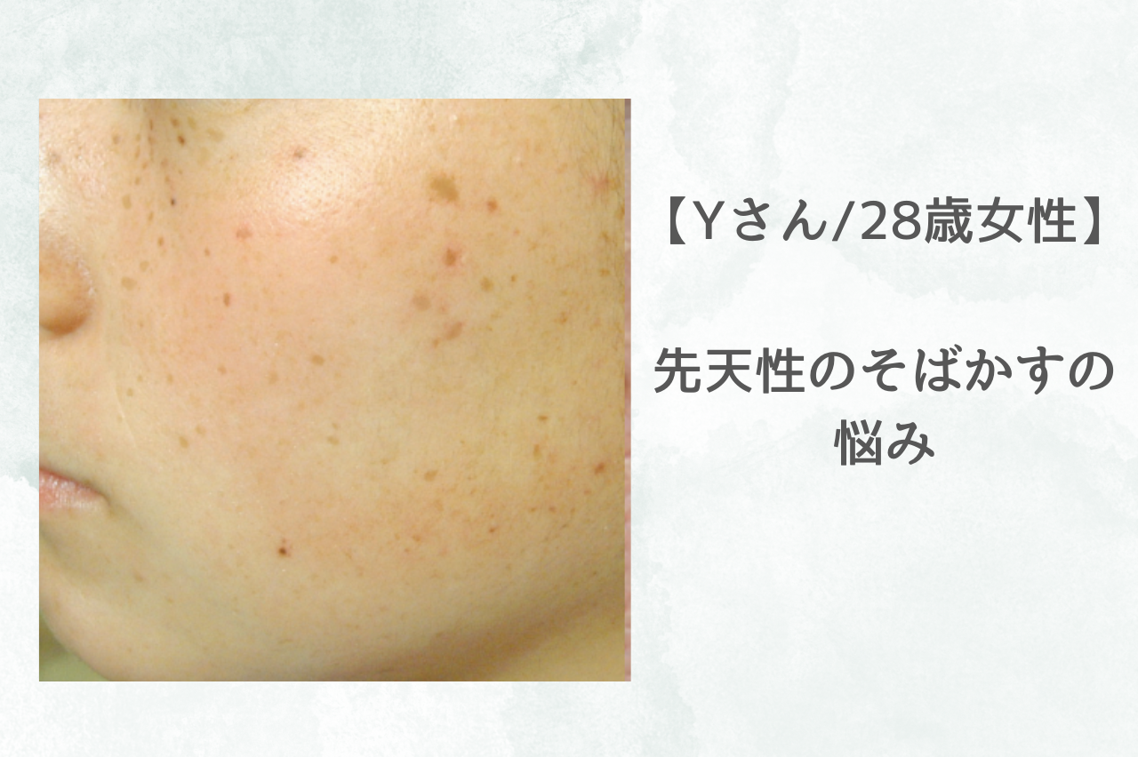 シロノクリニック　シミ取り　口コミ