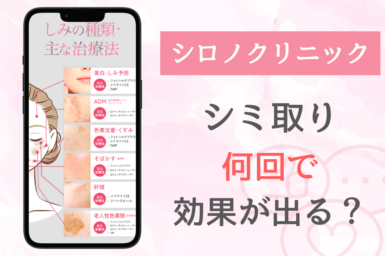 シロノクリニック　シミ取り　効果