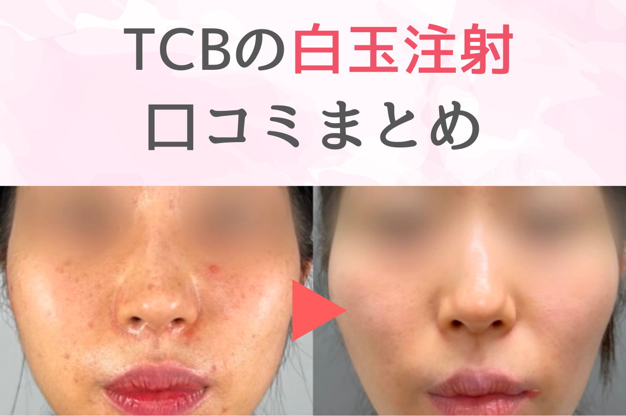 TCB 白玉点滴　口コミ
