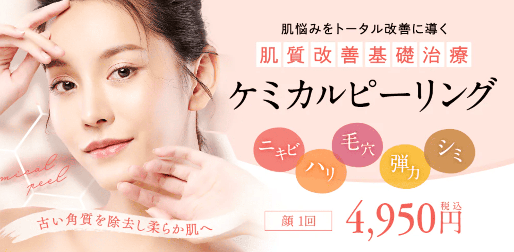 湘南　ケミカルピーリング