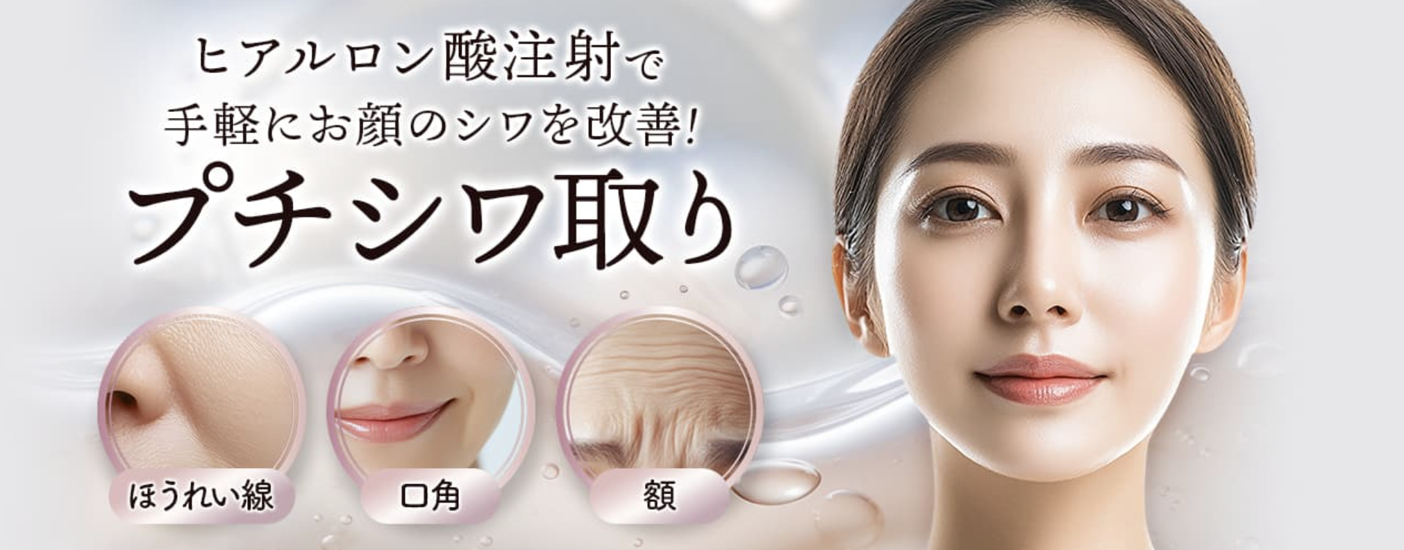 ほうれい線　ヒアルロン酸