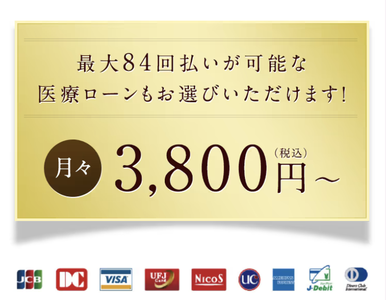 分割払い・医療ローンについて