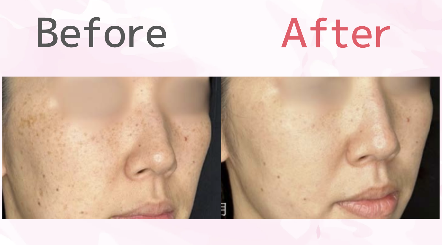 ルラクリニック　ルメッカ　口コミ　症例