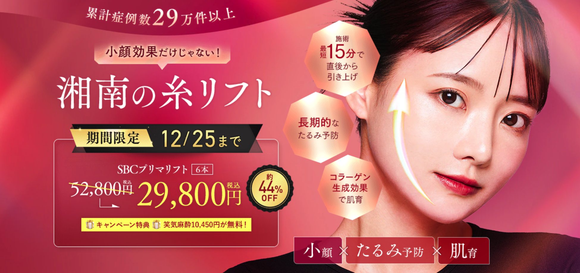 湘南　糸リフト　