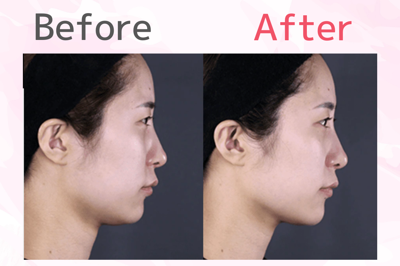 湘南　ハイフ　口コミ