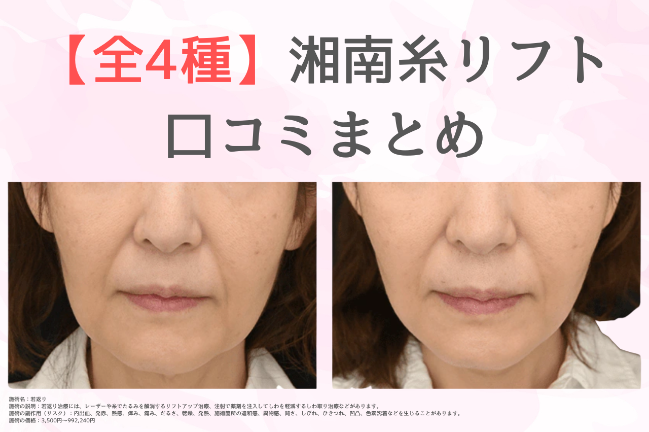 湘南　糸リフト　口コミ