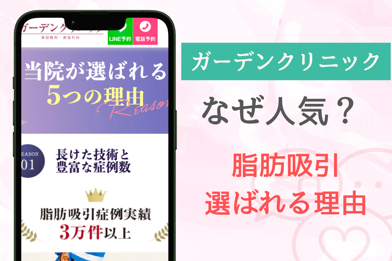 ガーデンクリニックの脂肪吸引が選ばれる理由