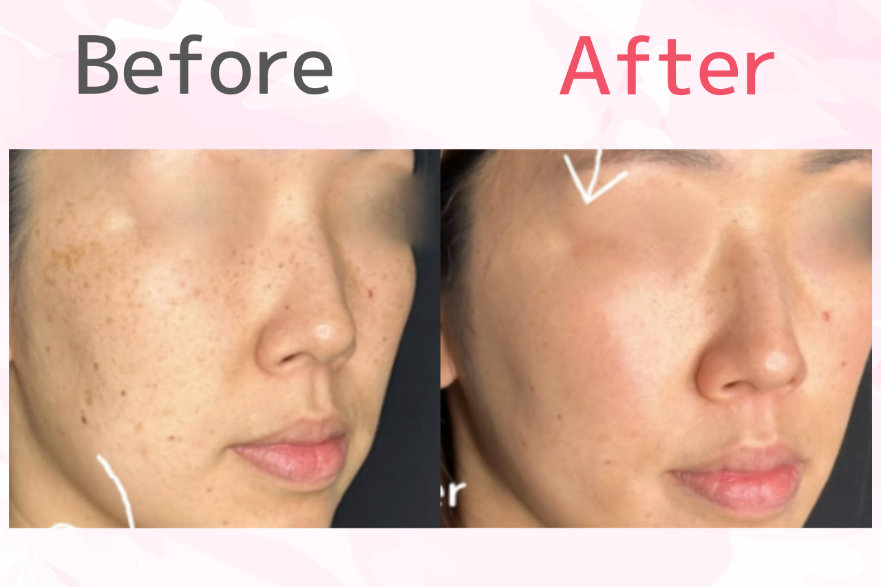 ルラクリニック　ルメッカ　口コミ　症例