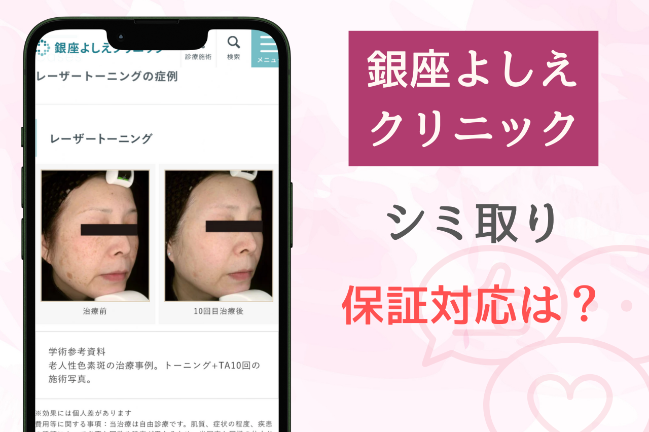 銀座よしえクリニックのシミ取りで効果を感じなかった場合の保証対応は？