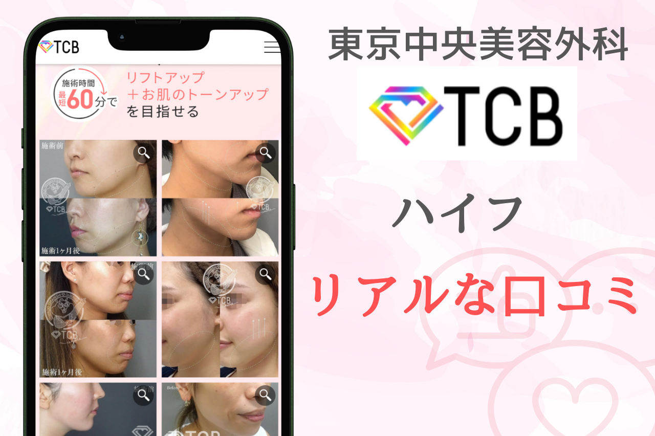 TCBハイフを体験した人のリアル口コミレポート