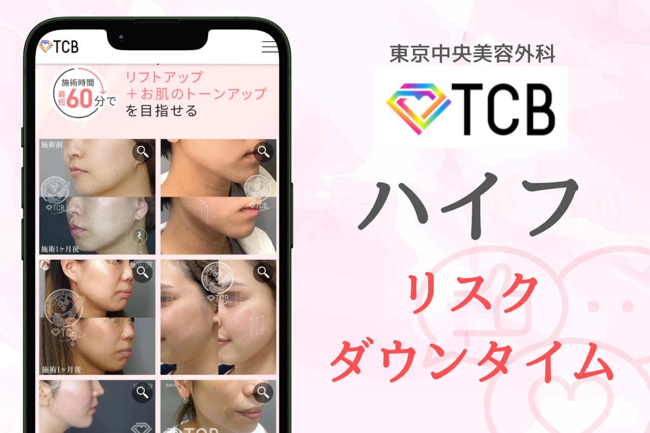 TCBハイフ（HIFU）のリスクとダウンタイム