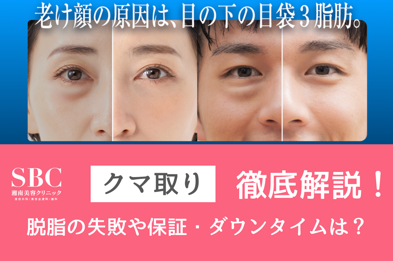 湘南のクマ取り口コミ徹底調査！脱脂の失敗や保証・ダウンタイムは？