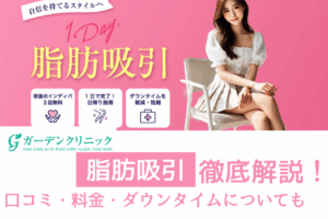 ガーデンクリニックの脂肪吸引口コミ・評判｜失敗例とダウンタイムを徹底解説