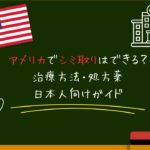 アメリカでシミ取りはできる？治療方法・処方薬・日本人向けガイド